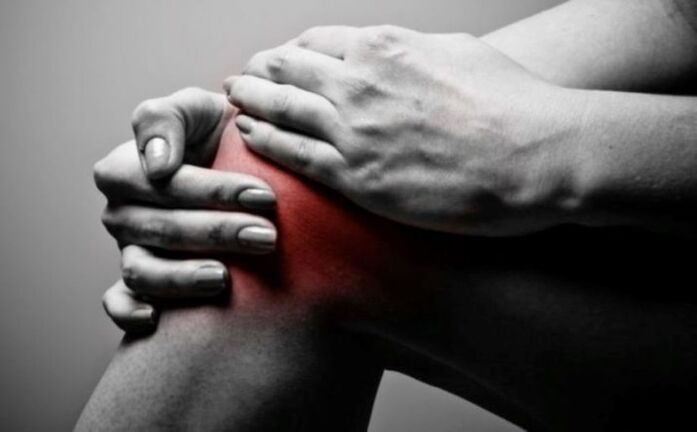 Arthritis des Kniegelenks