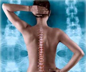 Illustration der hinteren Wirbelsäule