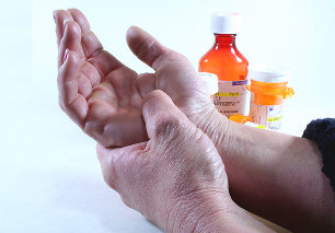 Methoden zur Behandlung von Arthritis und Arthrose