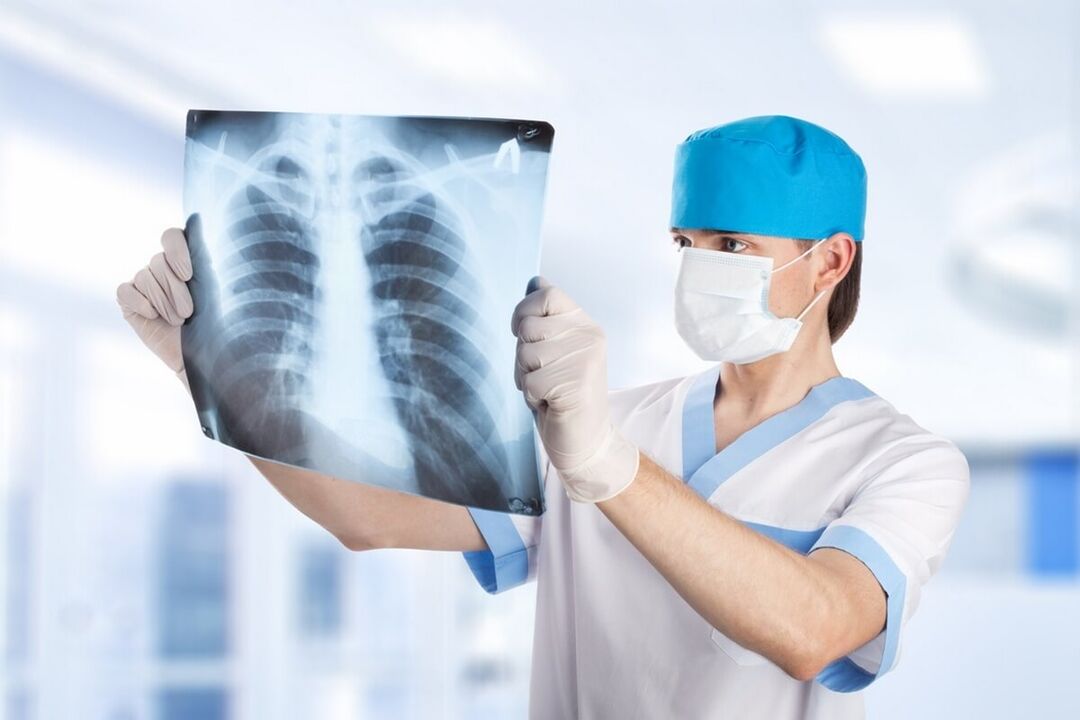 Röntgen der Brust mit Osteochondrose