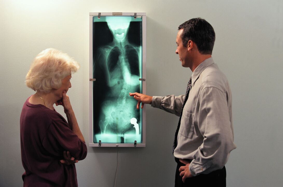 röntgendiagnostik bei schmerzen im hüftgelenk