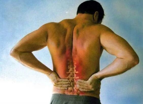 Schmerzen für die lumbale Osteochondrose